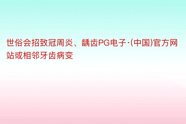 世俗会招致冠周炎、龋齿PG电子·(中国)官方网站或相邻牙齿病变