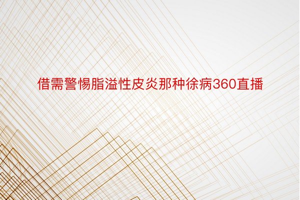 借需警惕脂溢性皮炎那种徐病360直播